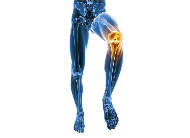  膝關(guān)節(jié)退行性病變