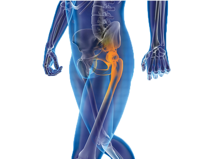  髖關(guān)節(jié)疾病