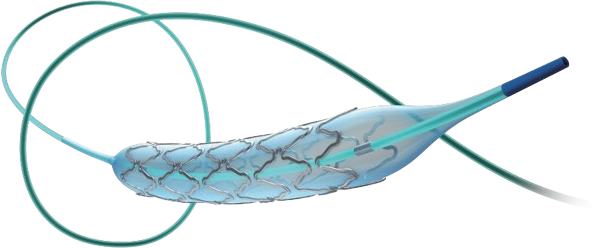 顱內(nèi)動脈支架系統(tǒng)