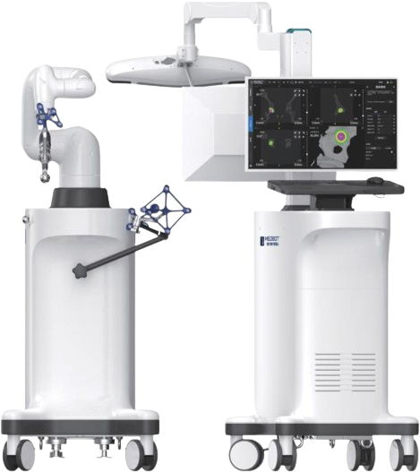 骨科關節(jié)置換手術導航定位系統(tǒng)