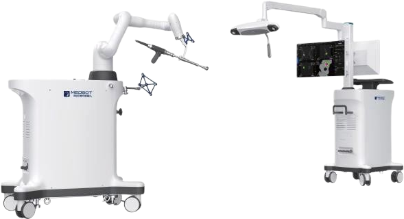 膝關節(jié)置換手術導航定位系統(tǒng)