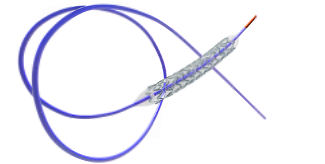 冠脈雷帕霉素洗脫鈷基合金支架系統(tǒng)