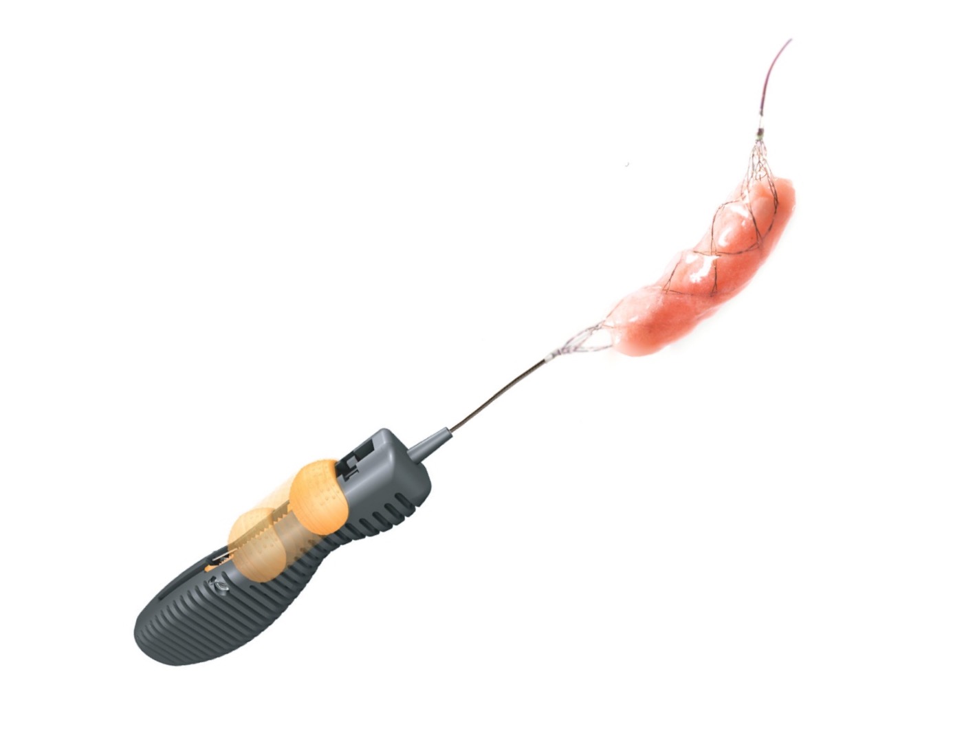 顱內(nèi)取栓支架