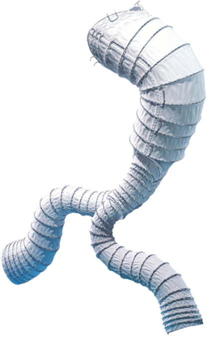 腹主動脈覆膜支架系統(tǒng)