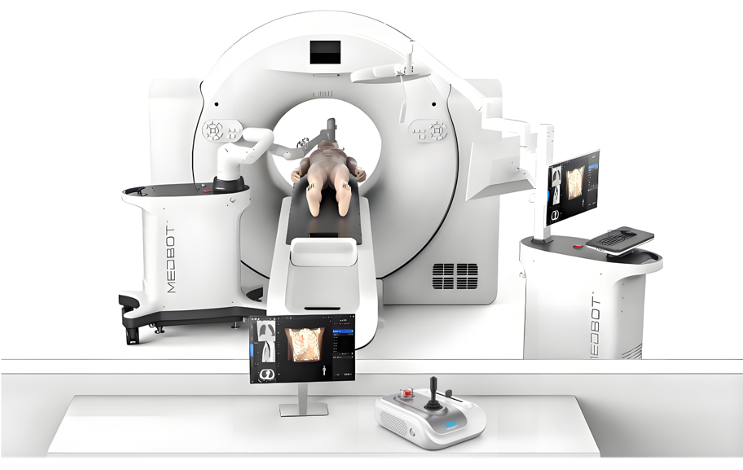 穿刺手術導航定位系統(tǒng)