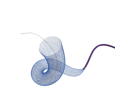 血流導(dǎo)向密網(wǎng)支架