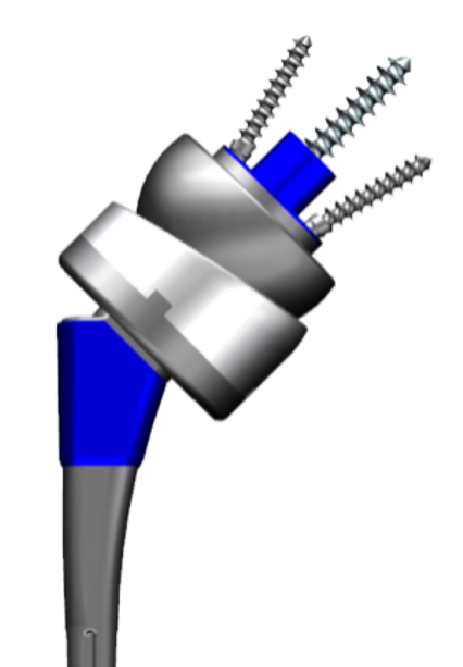 肩關(guān)節(jié)系統(tǒng)