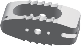 脊柱椎間融合器