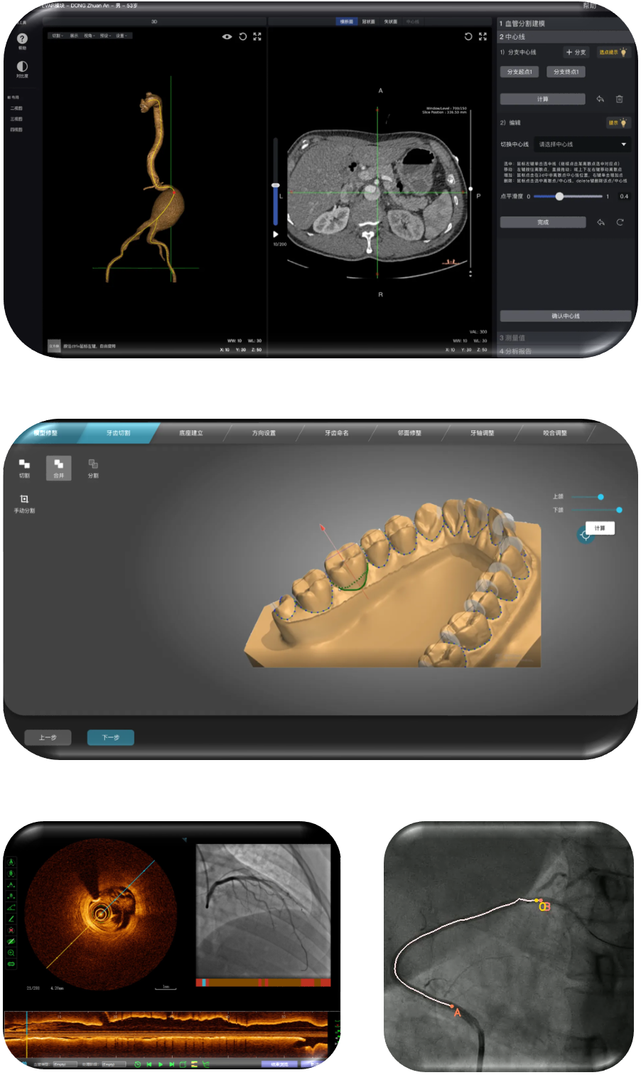 人工智能疾病輔助分診/診斷軟件