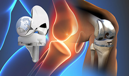 膝關(guān)節(jié)疾病與術(shù)式