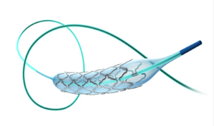 顱內(nèi)狹窄球囊擴(kuò)張支架成形術(shù)