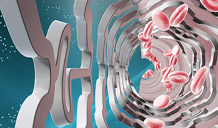 經(jīng)皮冠狀動(dòng)脈介入治療