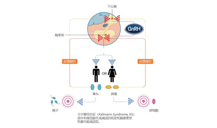 垂體激素輸液泵治療