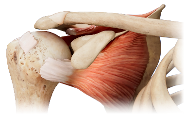 肩袖損傷與臨床術(shù)式